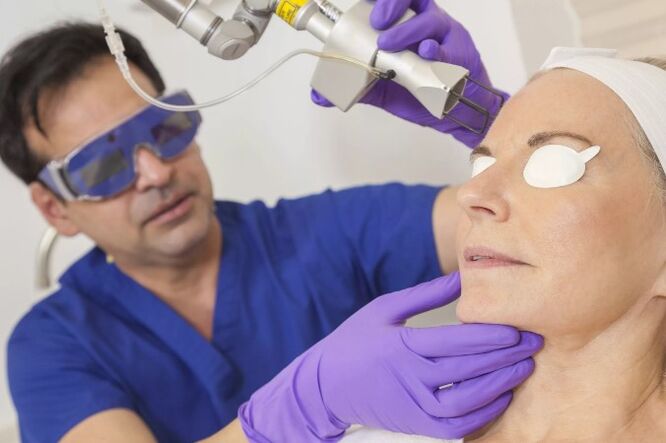 Verjüngung der Haut mit einem Laser